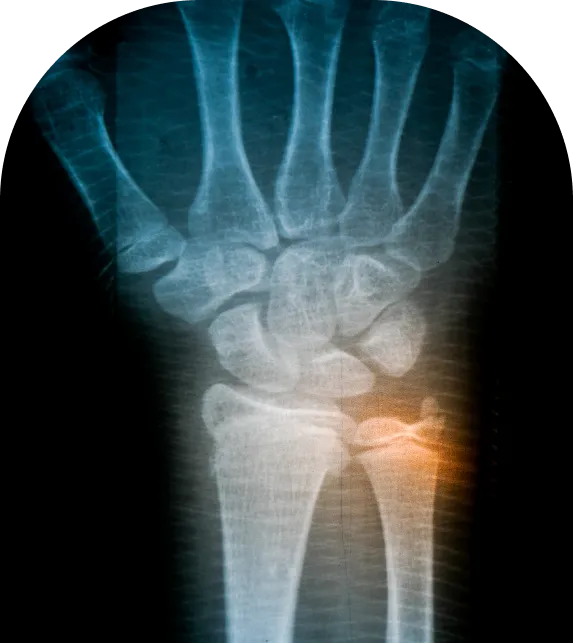 xray of wrist